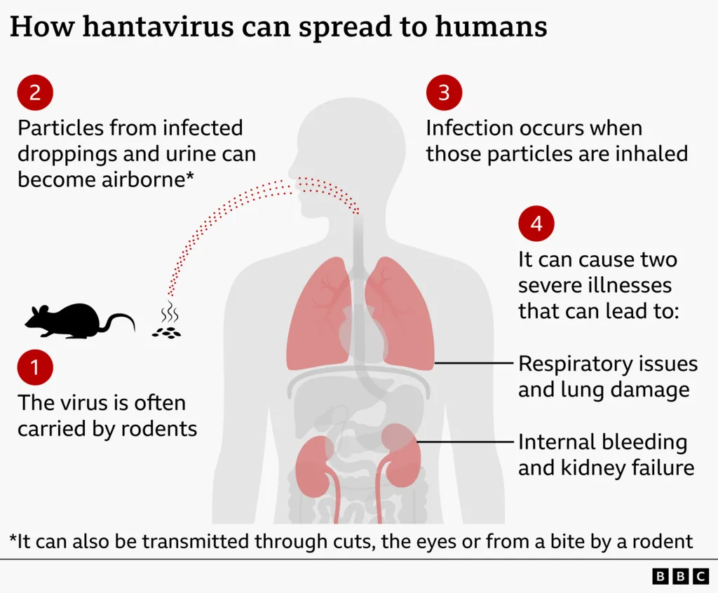 hantavirus 123