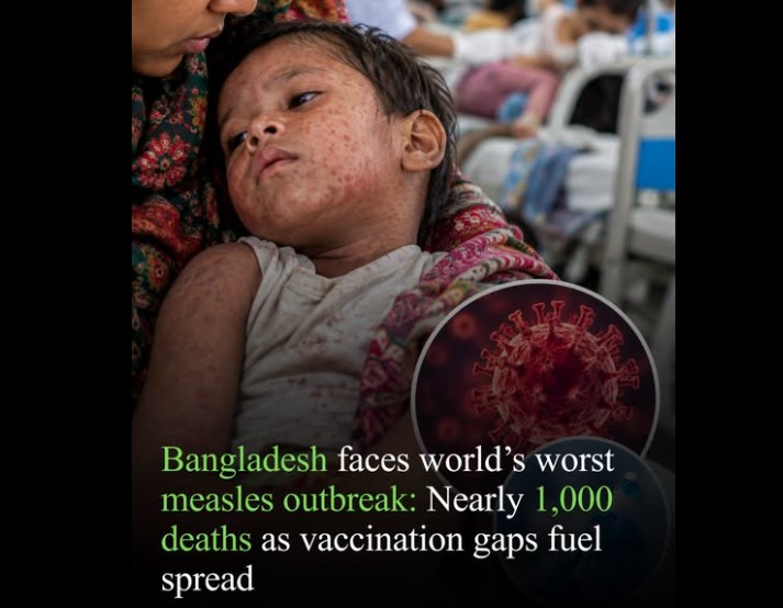Measles outbreak in Bnagladesh